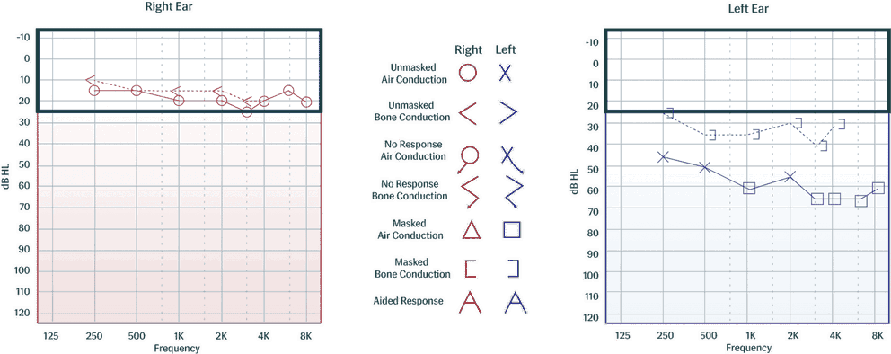 The Audiogram