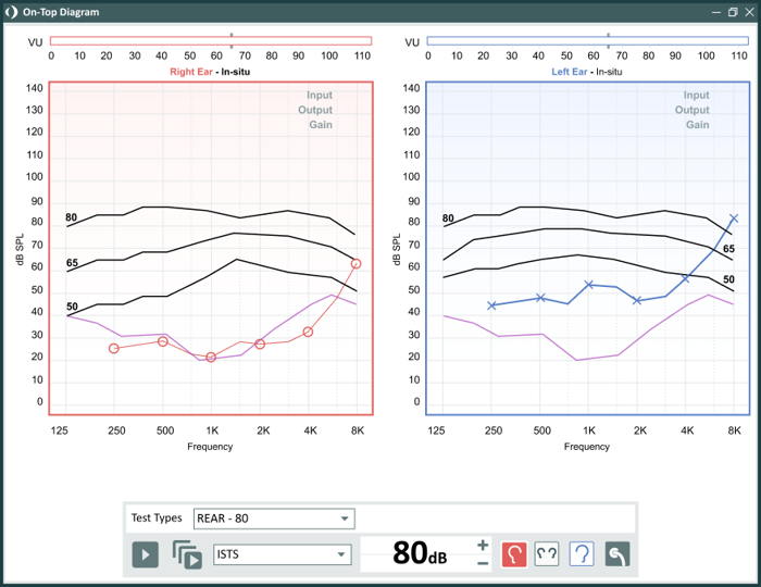 REM Measurement Screen