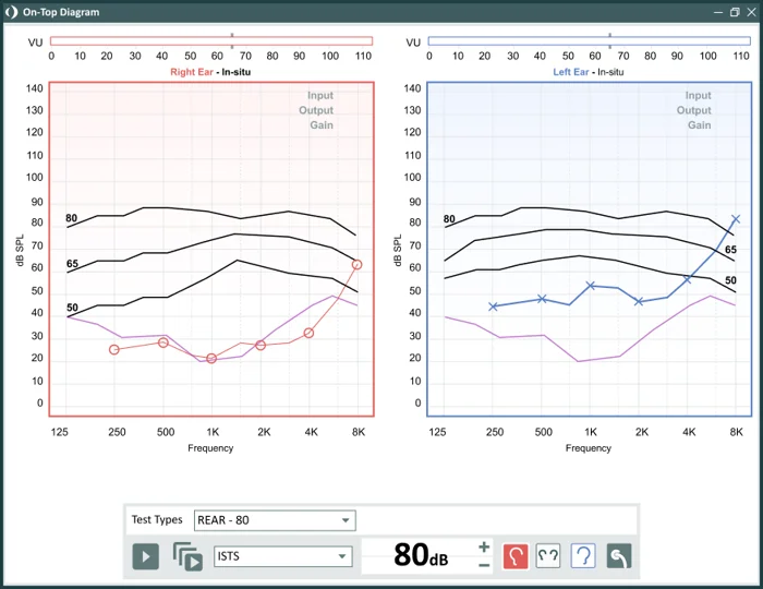 REM Measurement Screen