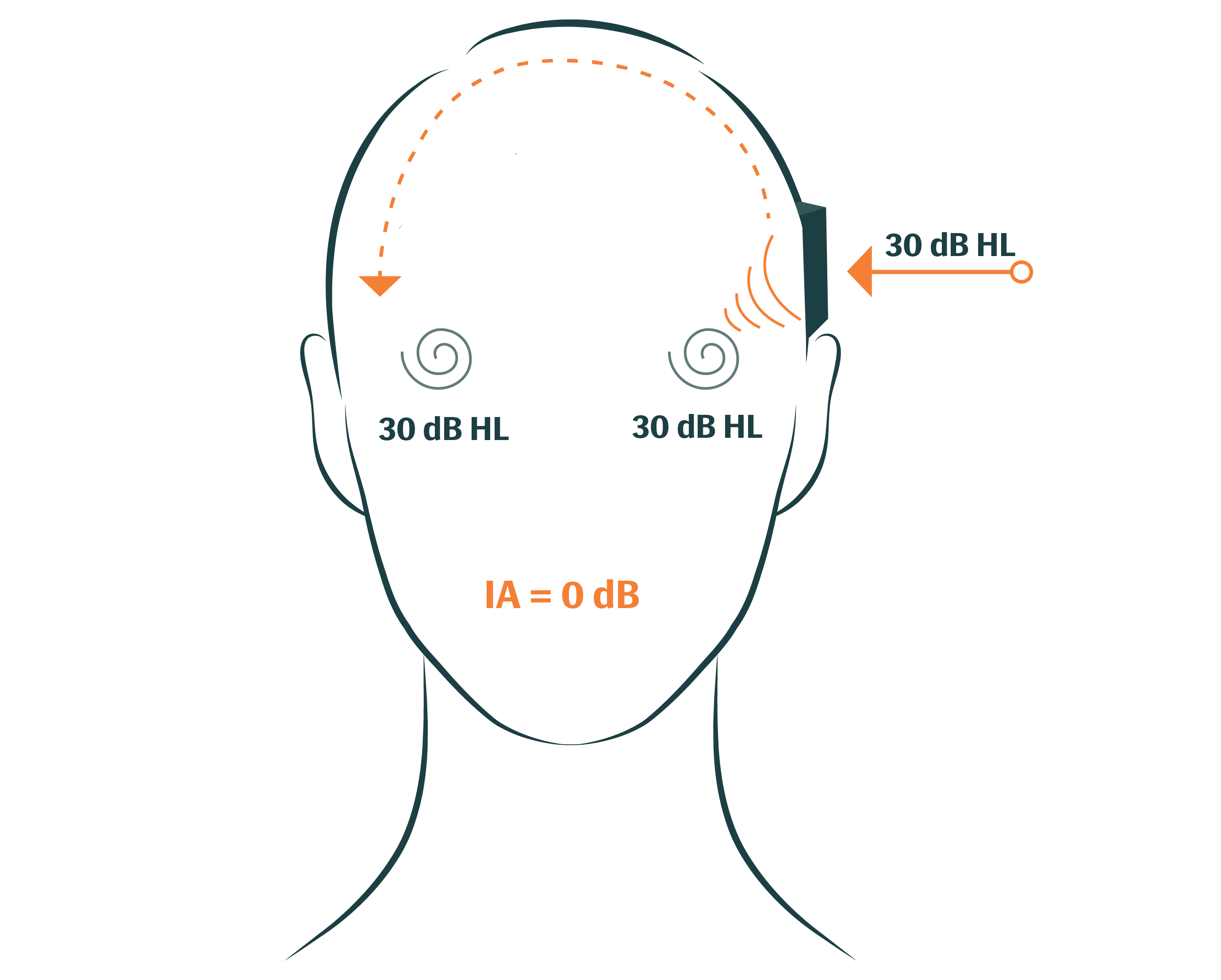 Bone Conduction Testing: What Is Bone Conduction?