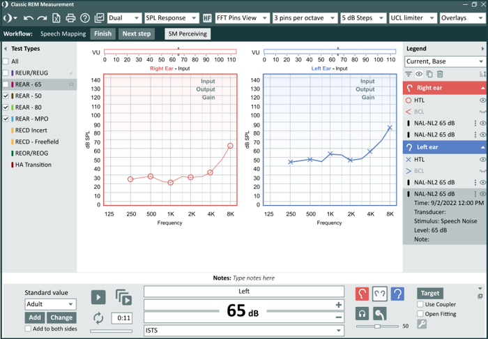 REM Screen Measure